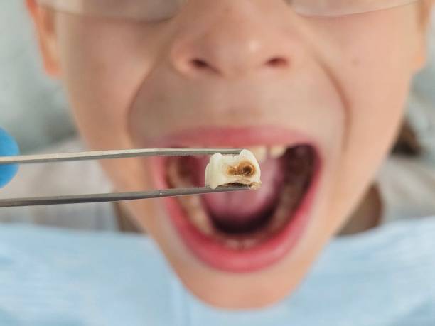 Best Emergency Dental Services for Seniors in Woodstown, NJ