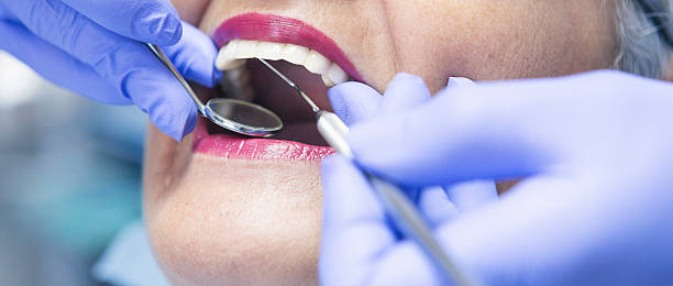 Best Emergency Dentist for Lost Fillings or Crowns in Woodstown, NJ